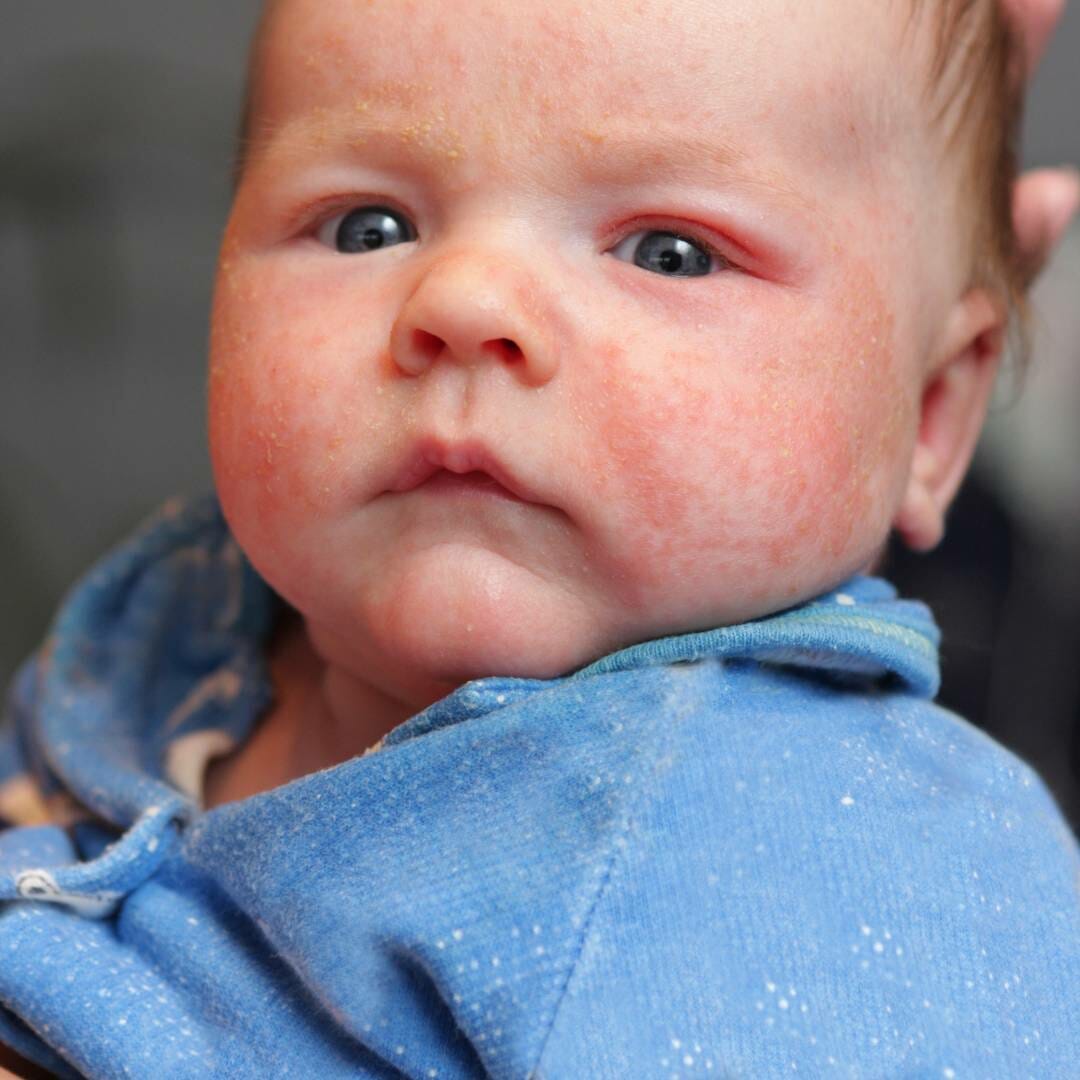 What Are The Benefits Of Oatmeal Baths? Big Bathroom Shop